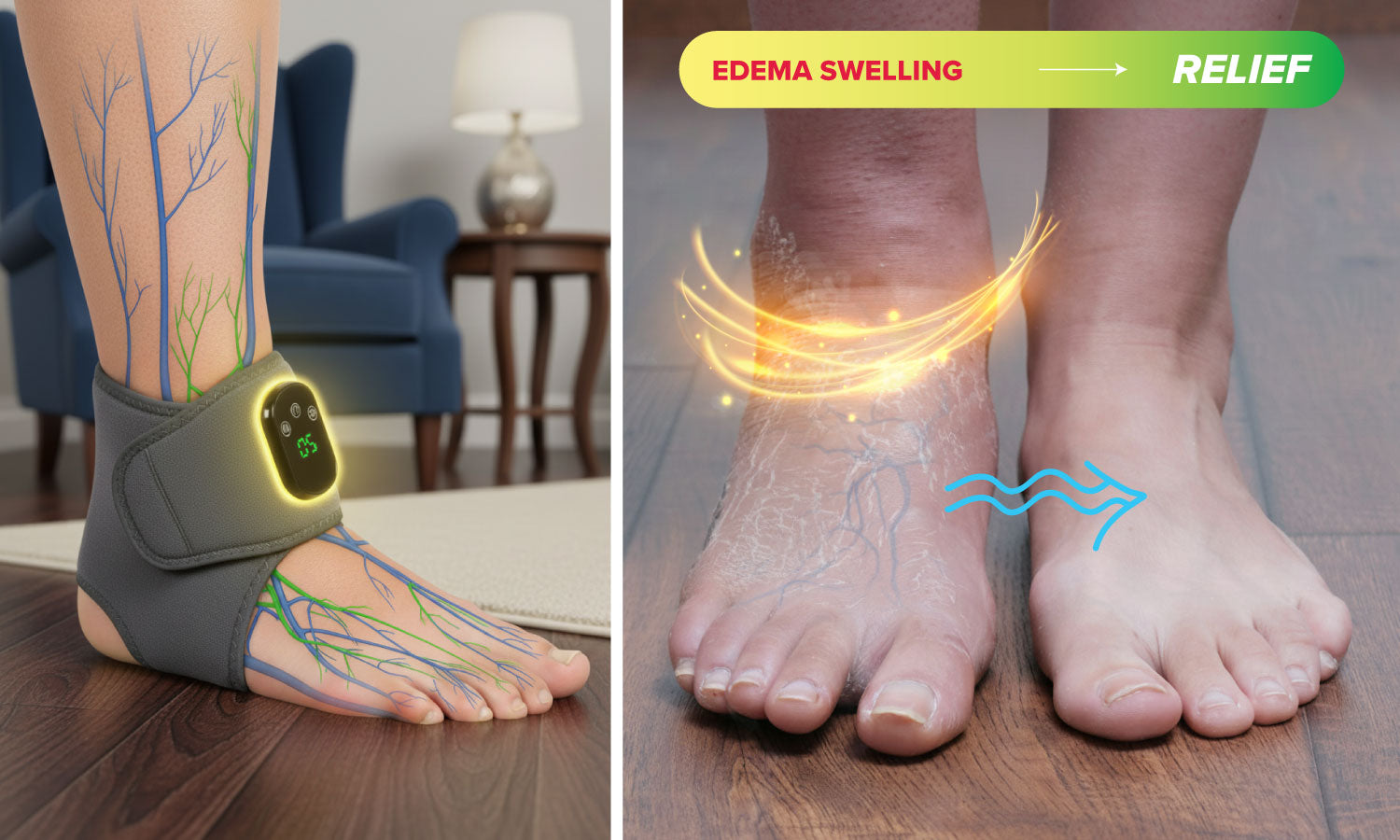 Swollen feet showing fluid buildup